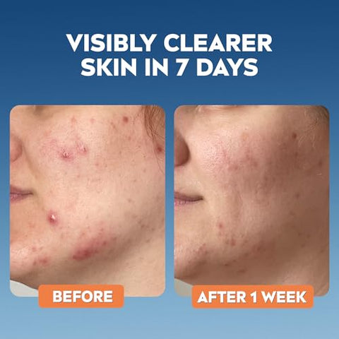 NIVEA Derma Skin Clear Wash Gel (150ml), Deep Cleansing Salicylic Acid Face Wash Enriched with Niacinamide to Cleanse Pores and Remove Impurities, For Blemish-Prone Skin
