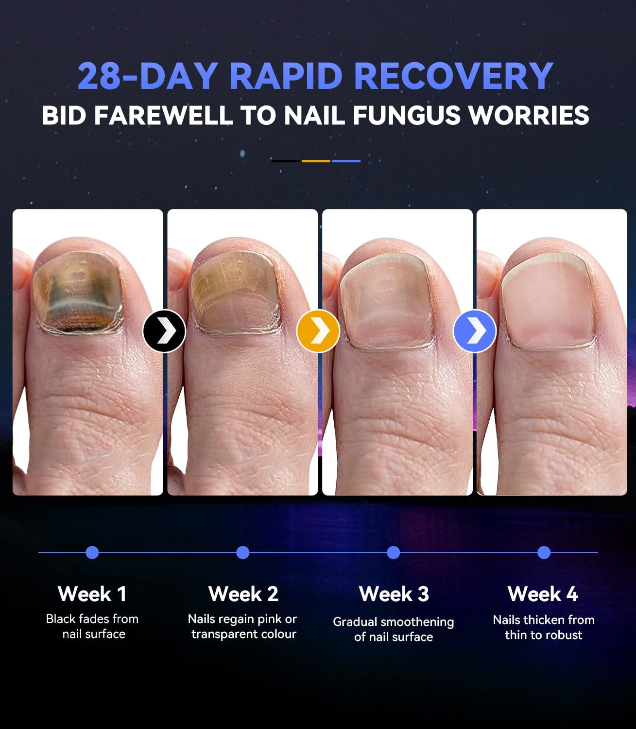 IUHFSIFS Upgrade Nail Fungus Laser Device【Industry NO.1 Innovation】Nail Fungus Treatment for Toenail Finger Nail Infection, 950nm Infrared 470nm Blue