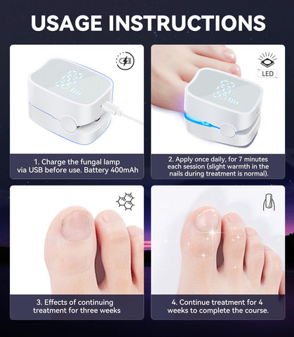 IUHFSIFS Upgrade Nail Fungus Laser Device【Industry NO.1 Innovation】Nail Fungus Treatment for Toenail Finger Nail Infection, 950nm Infrared 470nm Blue
