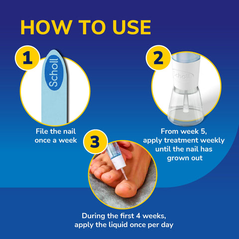 Scholl 2-in-1 Fungal Nail Treat & Prevent Kit, 3.8ml - Treats the Infection at Source, Fast-Drying Formula, Easy to Use, Clinically Proven Antifungal Treatment for Toenails, 5 Disposable Nail Files