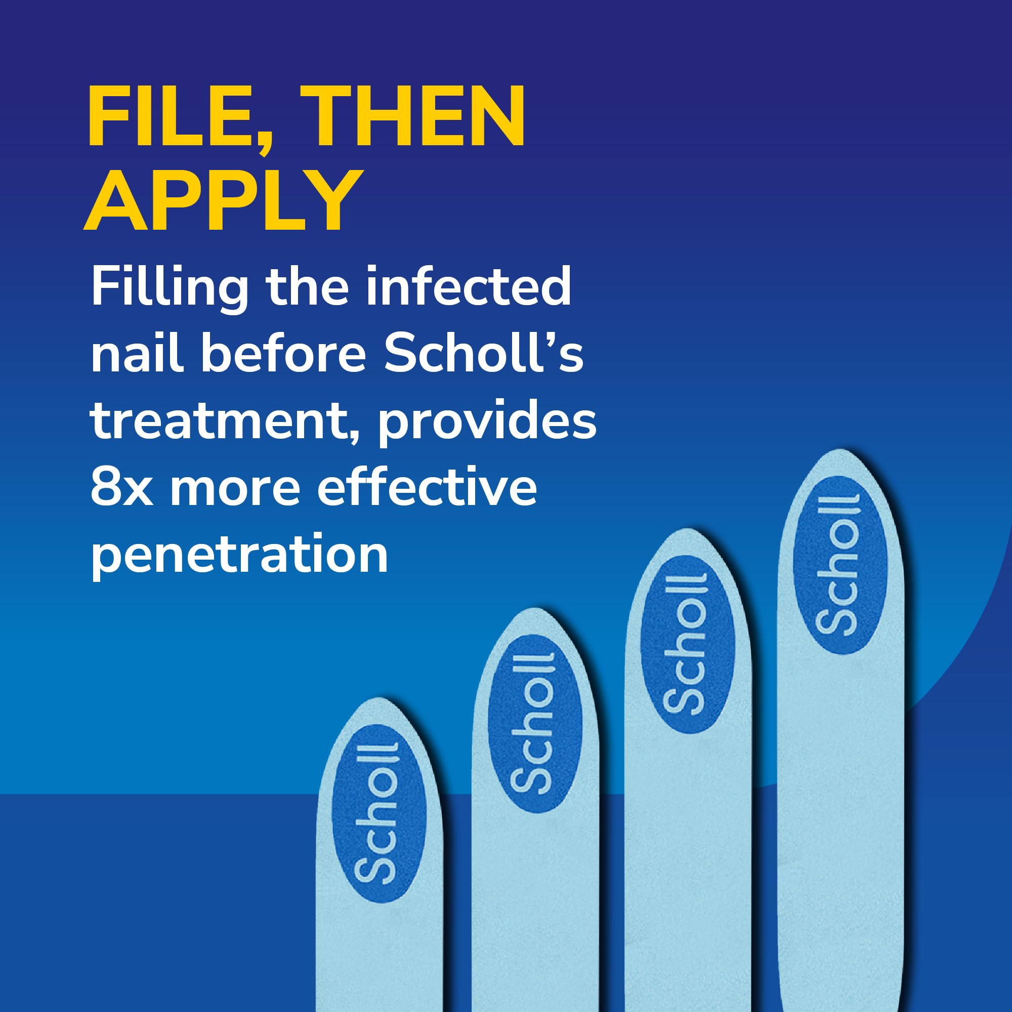 Scholl 2-in-1 Fungal Nail Treat & Prevent Kit, 3.8ml - Treats the Infection at Source, Fast-Drying Formula, Easy to Use, Clinically Proven Antifungal Treatment for Toenails, 5 Disposable Nail Files
