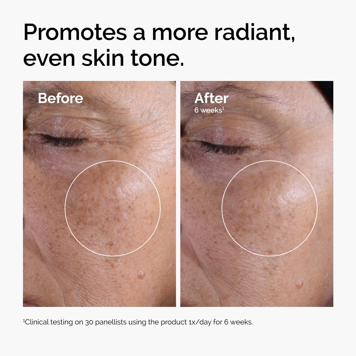 The Ordinary Glycolic Acid 7% Exfoliating Toner, Brightening and Smoothing Daily Toner for More Even-Looking Skin Tone, 240ml