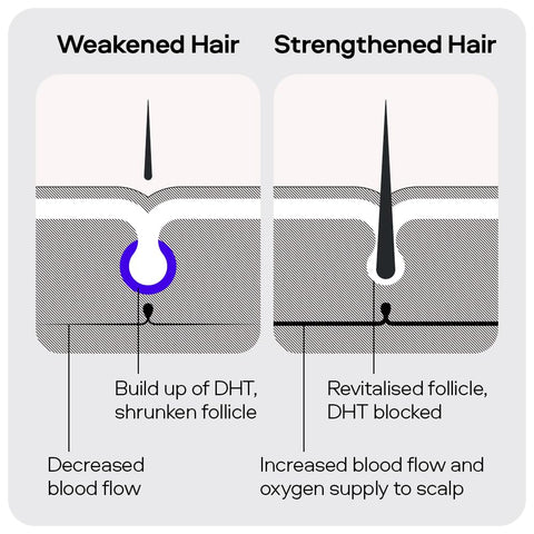 Sons Minoxidil 5% Cutaneous Solution for Men, Hair Regrowth & Thickener Formula, For Hair Loss & Thinning, Reactivates Shrunken Follicles, Precision Application System, 3 Month Supply Made in Europe