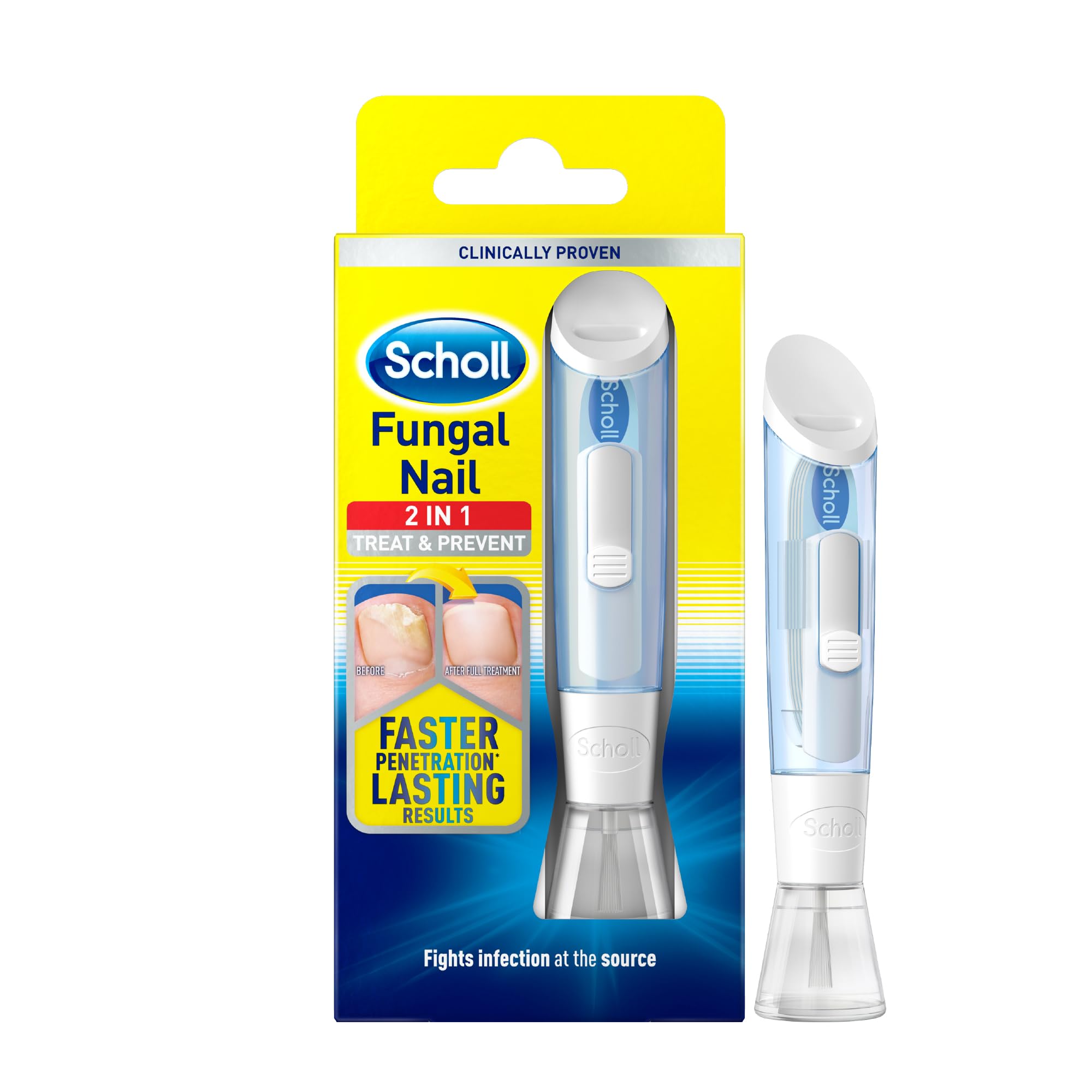 Scholl 2-in-1 Fungal Nail Treat & Prevent Kit, 3.8ml - Treats the Infection at Source, Fast-Drying Formula, Easy to Use, Clinically Proven Antifungal Treatment for Toenails, 5 Disposable Nail Files