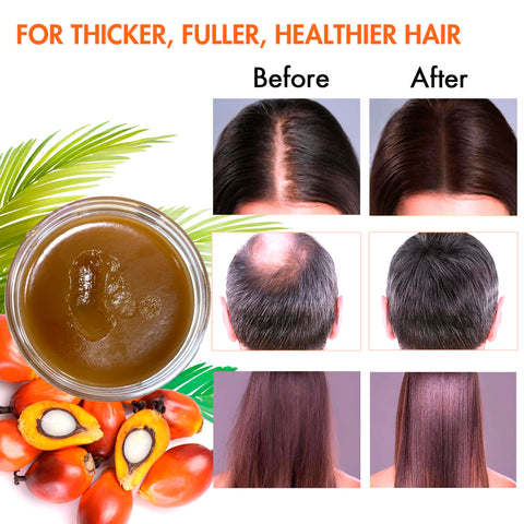 Raw Batana Oil for Hair Growth, 100% Natural Pure Dr. Sebi Botana Oil, Unrefined Organic Batana Hair Growth Oil for Prevent Hair Loss, Enhances Hair Thickness for Men & Women 5.3 oz